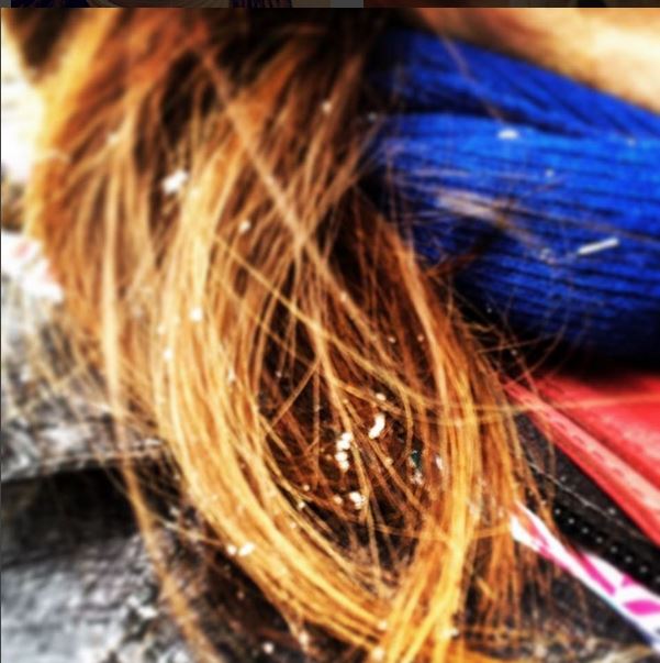 De la neige dans les cheveux